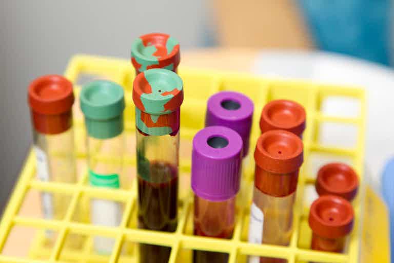 Multiple colored capped test tubes in a yellow rack, with red, purple, teal caps and liquid inside.