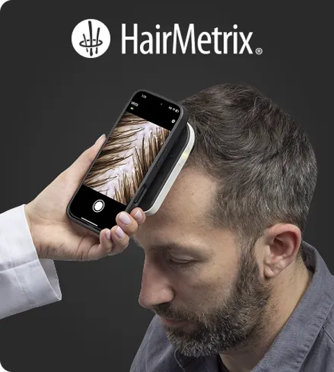 Man using a smartphone scanner app to photograph a scalp, with HairMetrix logo above.