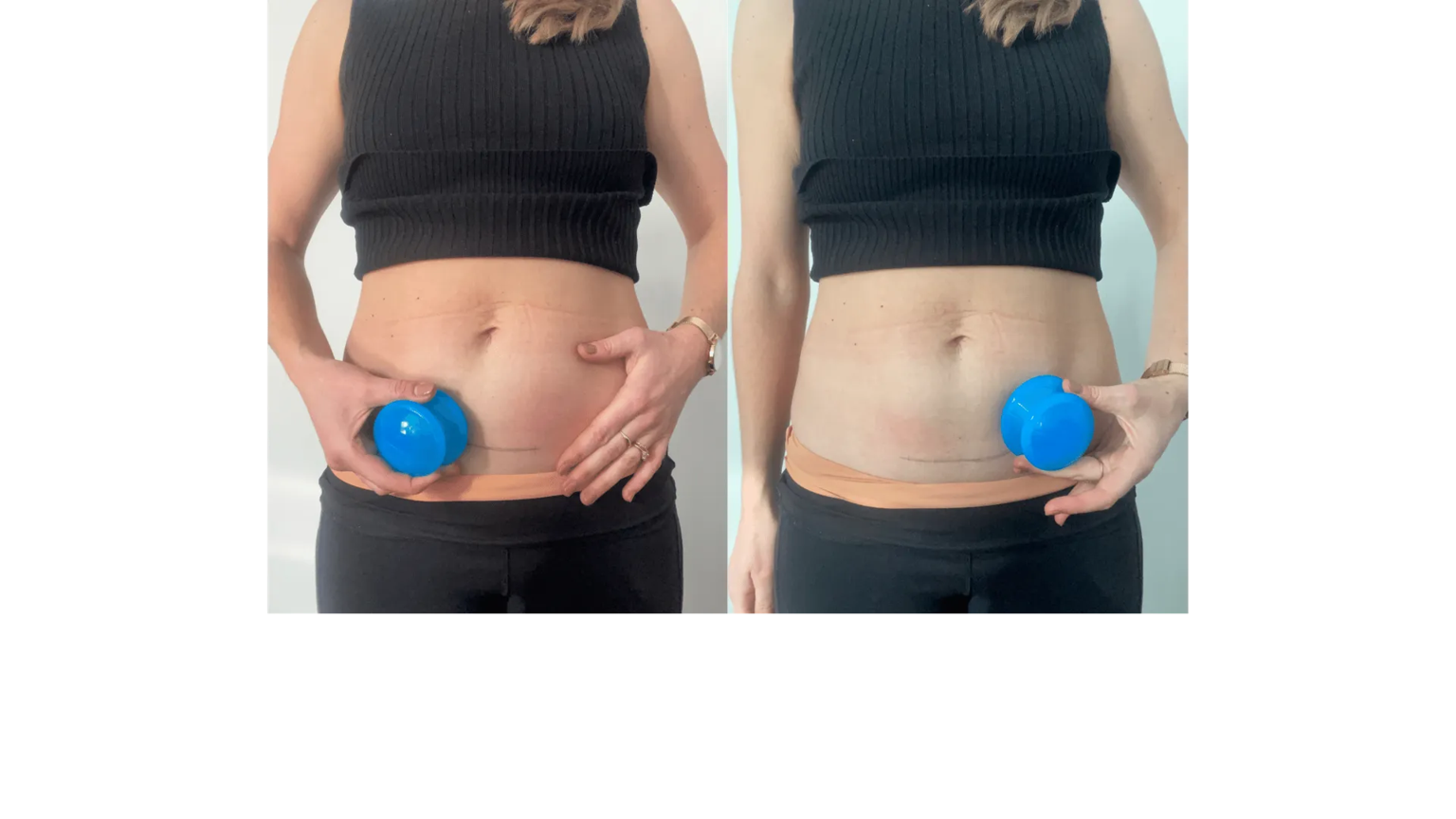 Two side-by-side photos of a woman holding blue measuring cups at her midsection, showing before-and-after belly changes