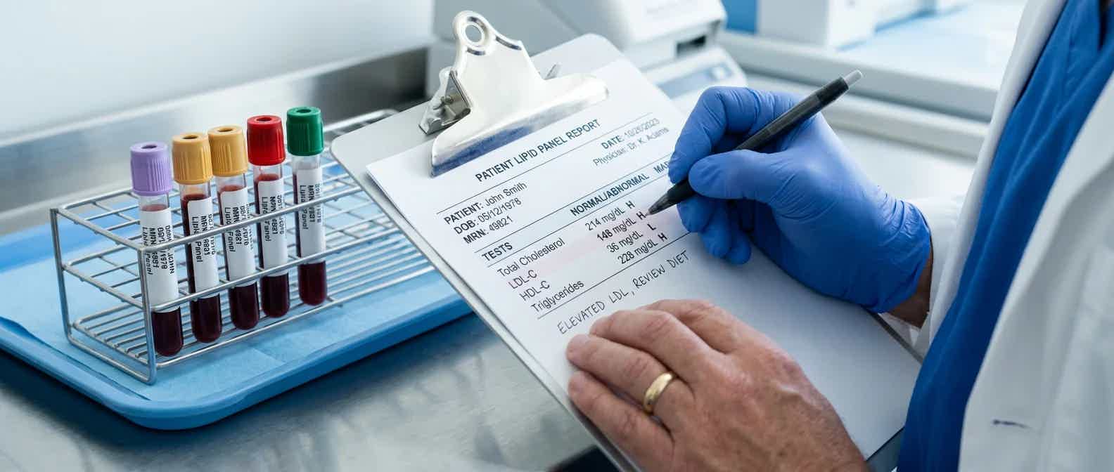 Close-up of a clinician's hands reviewing a lipid panel blood test report on a clipboard next to blood sample tubes, clean clinical lighting, soft blue and white tones, medical