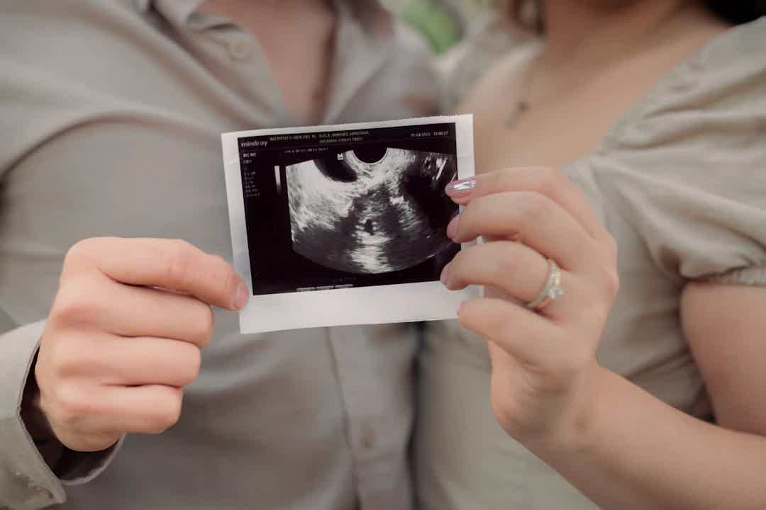 Understanding PCOS: Its Impact on Infertility Explained