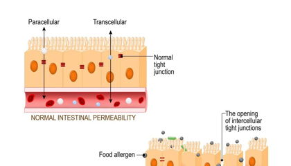 What is "leaky gut" (intestinal permeability)? And how do you fix it?