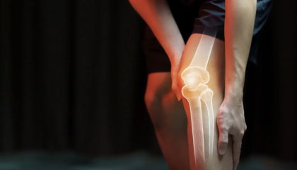 PRP for Knee Pain: An Honest Look at the Evidence