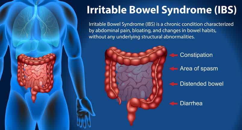 Symptoms, Causes, and Natural Treatments for IBS