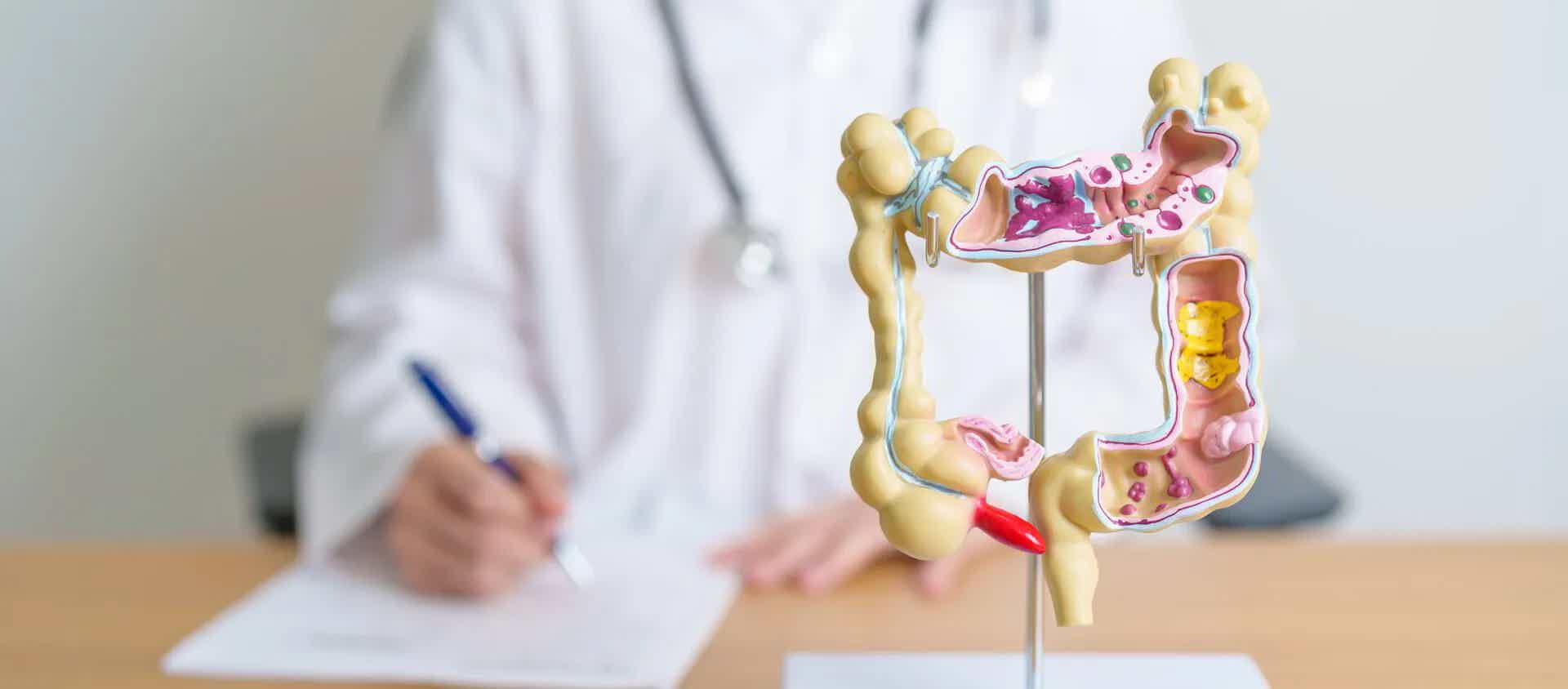 Colorectal Cancer Doesn't Care How Old You Are