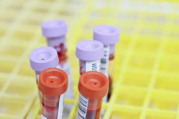 Hormone Blood Tests for Women: Understanding Estradiol, Progesterone and Testosterone Ranges