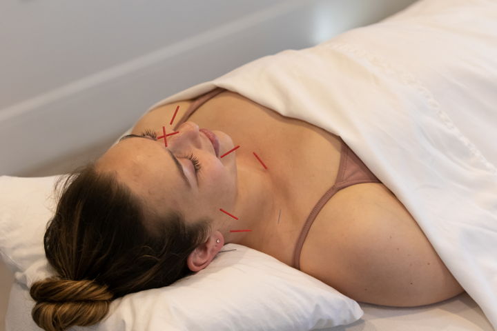 Natural Anti-Aging That Works: The Holistic Botox Alternative