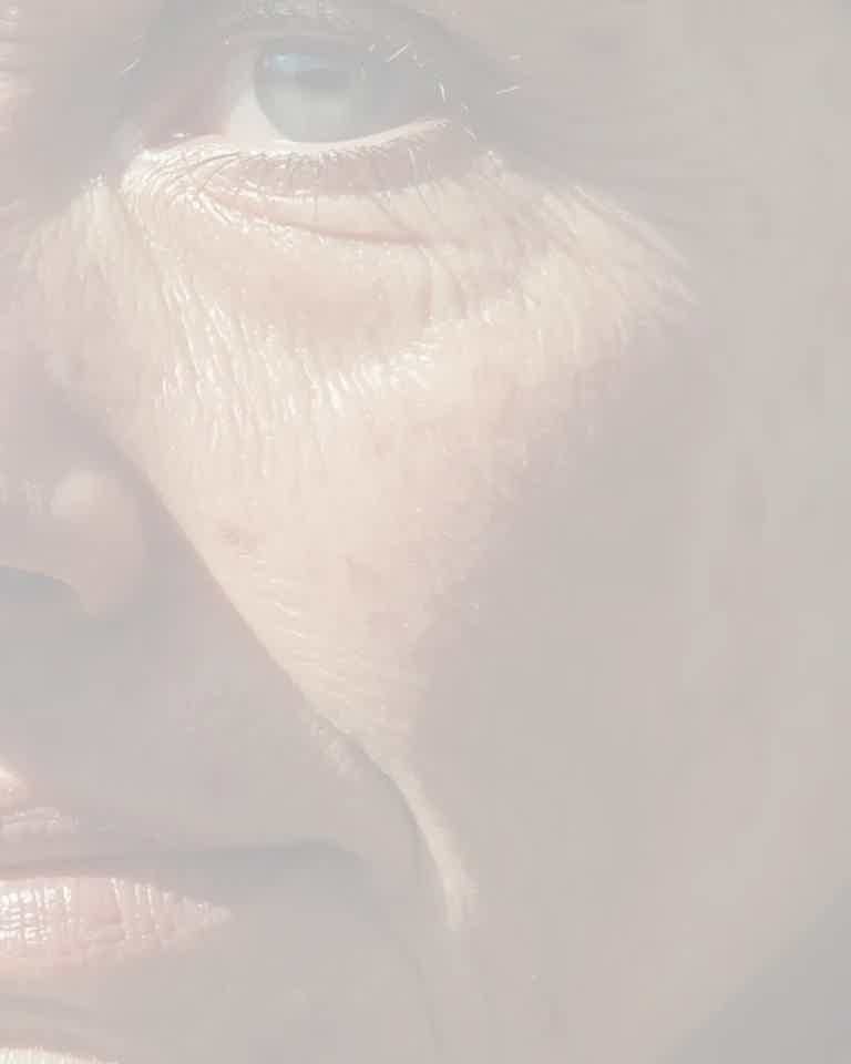 Close-up of mature skin with age spots, highlighting Biorevive treatment benefits available in Calgary for skin rejuvenation.