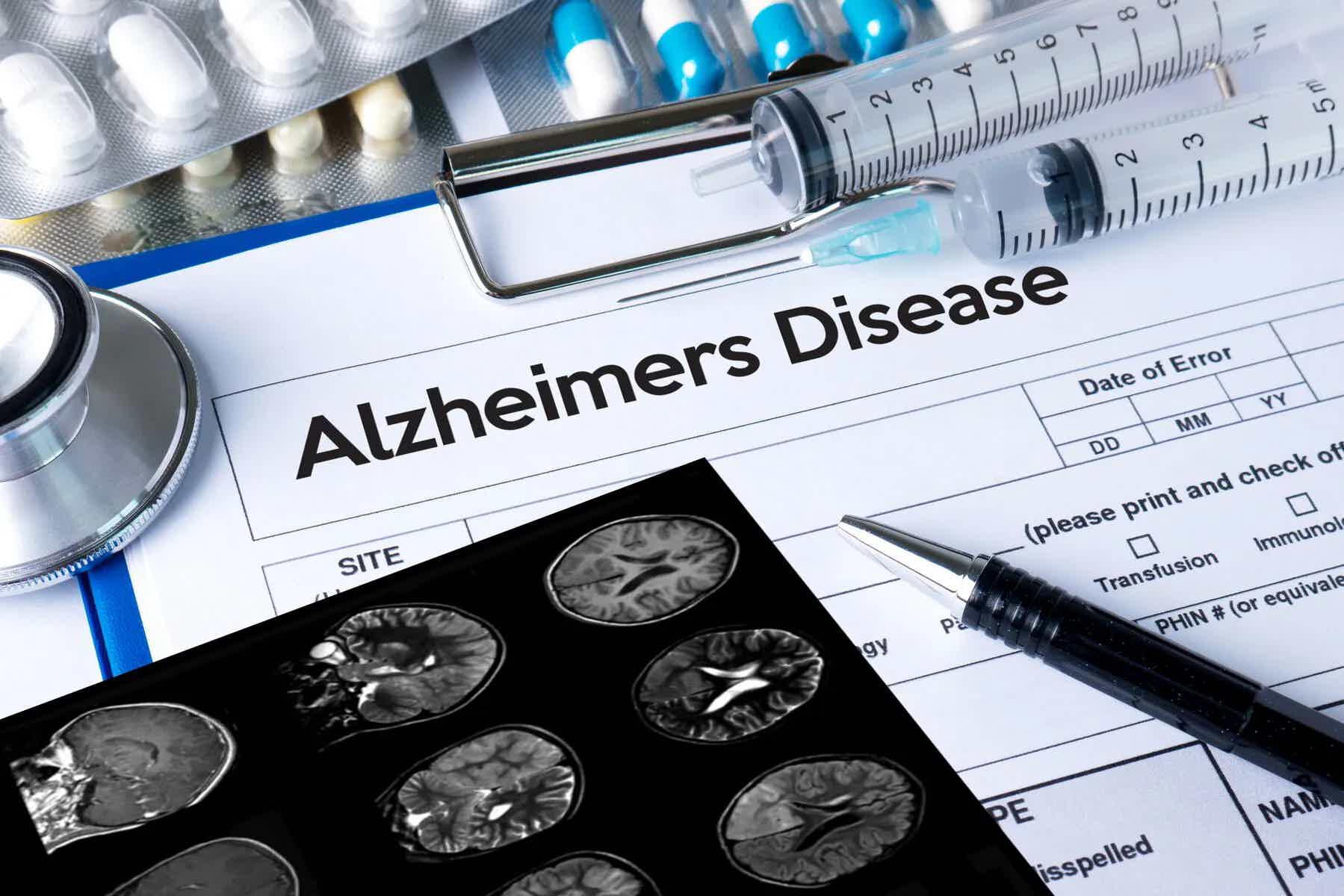 The Hidden Connection Between Blood Sugar and Alzheimer's: Natural Strategies for Prevention