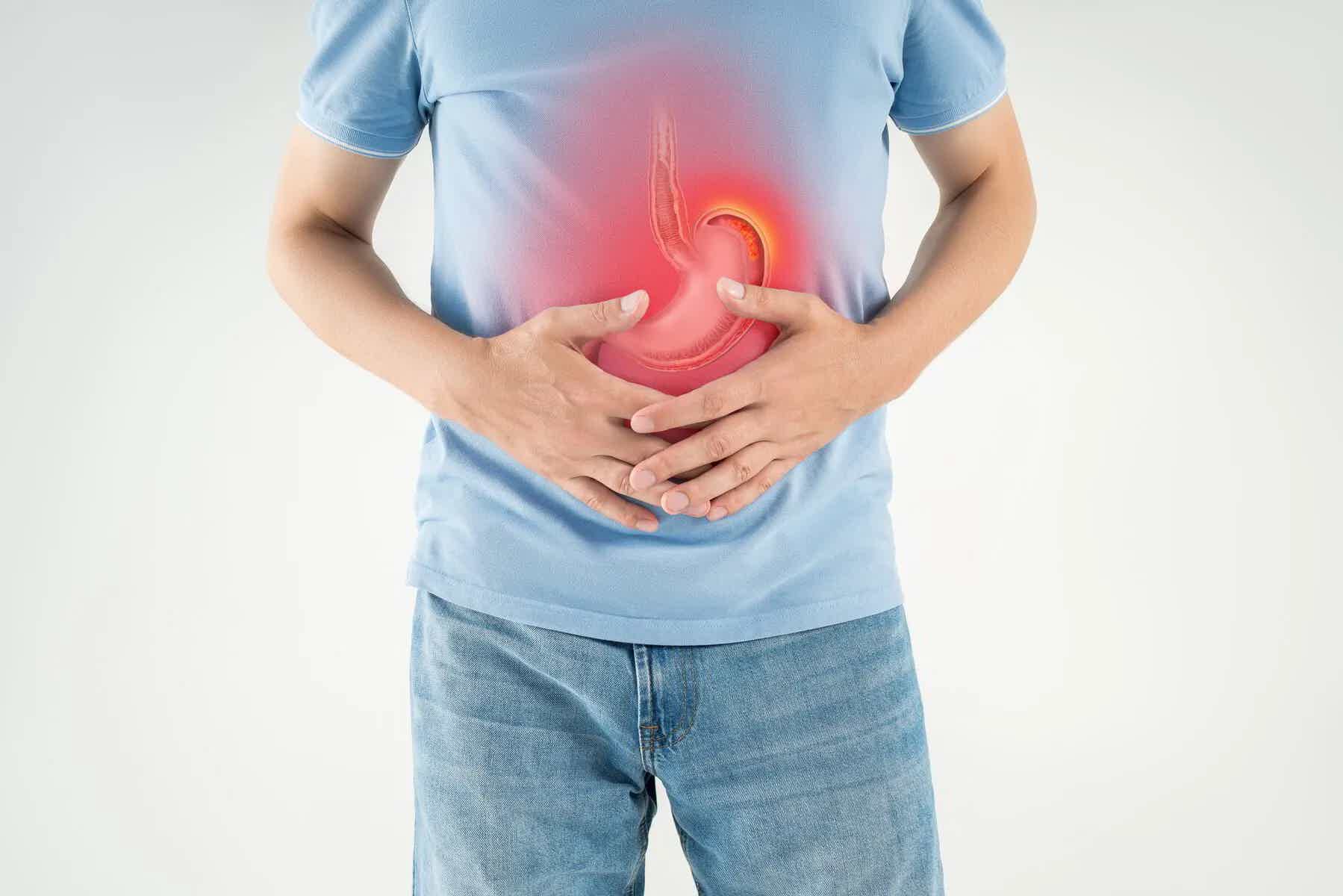 Peptic Ulcer Disease (PUD): Conventional and Natural Treatments