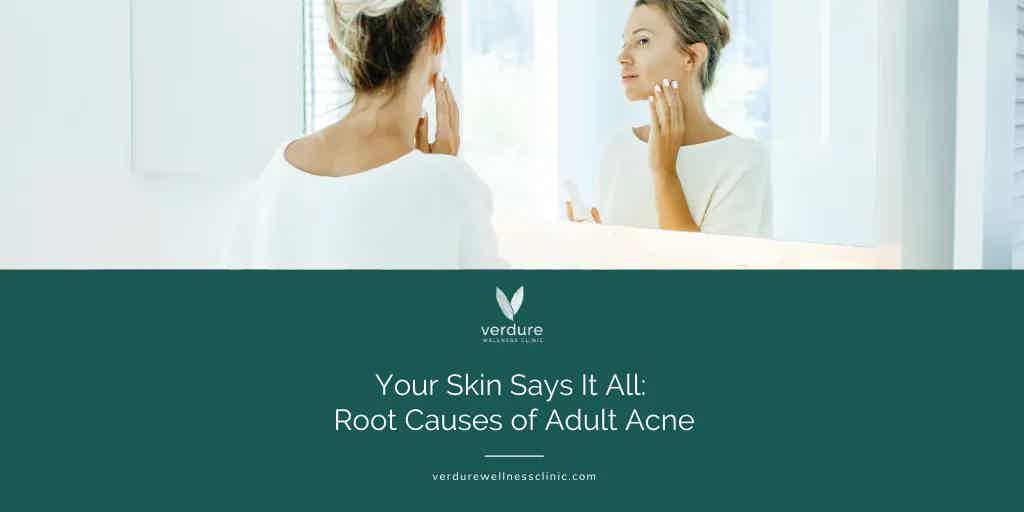 your-skin-says-it-all-root-cause-adult-acne