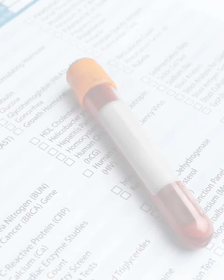 Advanced diagnostic lab testing for health optimization