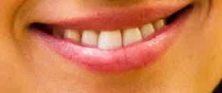 Oral Health - What is Oil Pulling?