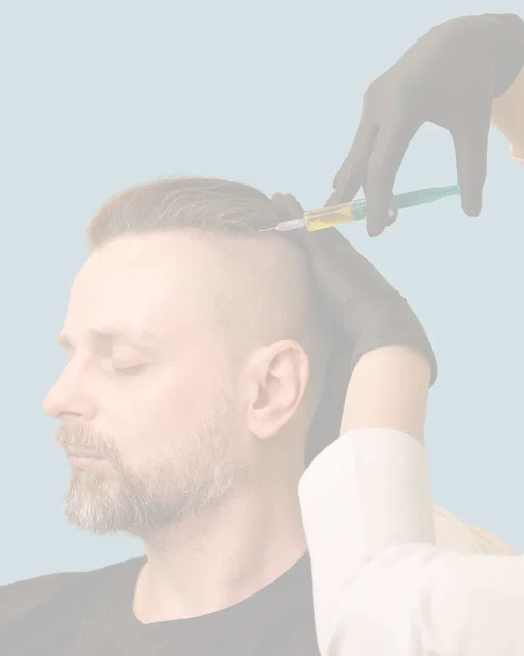 BioRevive Calgary patient undergoing PRP hair restoration therapy, using platelet-rich plasma to stimulate hair follicles and improve density.