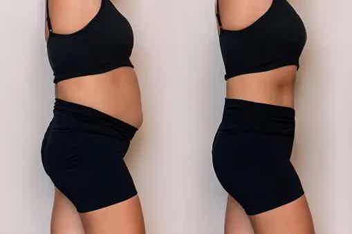 Abdominophrenic dysynergia (APD): What to know about this common cause of chronic bloating
