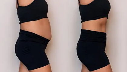 Abdominophrenic dysynergia (APD): What to know about this common cause of chronic bloating