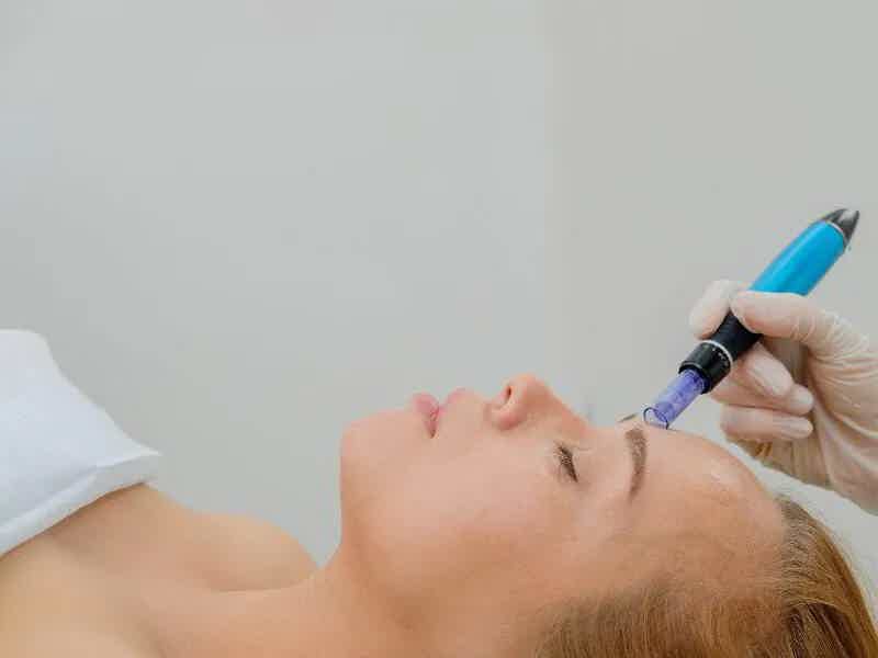 PRP Facials | Clementine